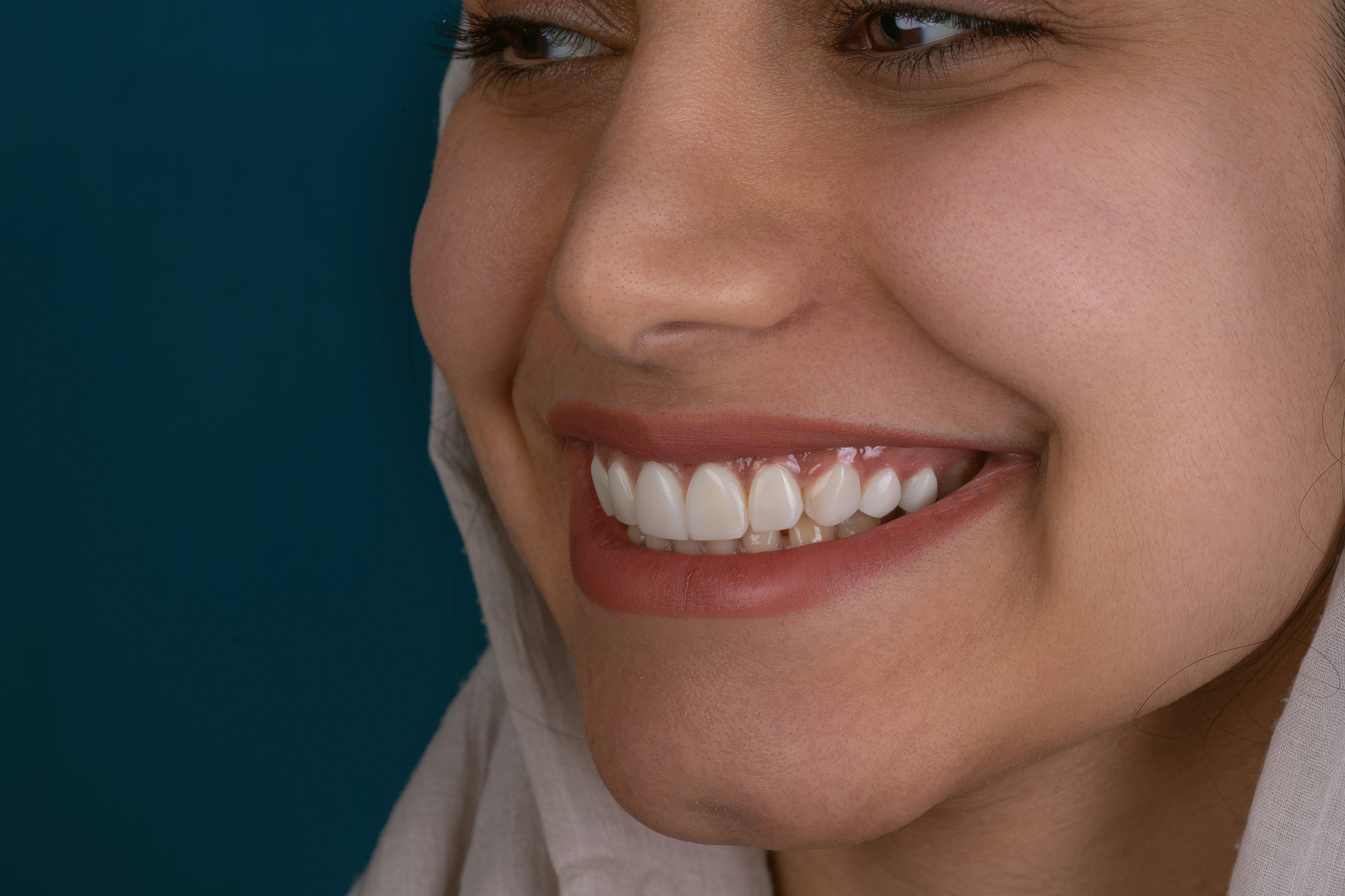 Smile transformation before and after